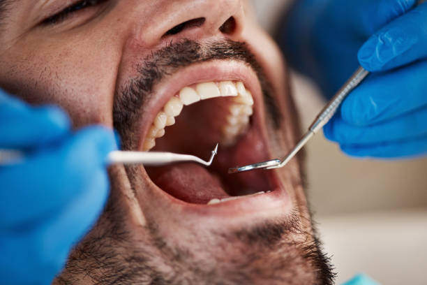 Best Mobile Emergency Dentist in Henderson, NC