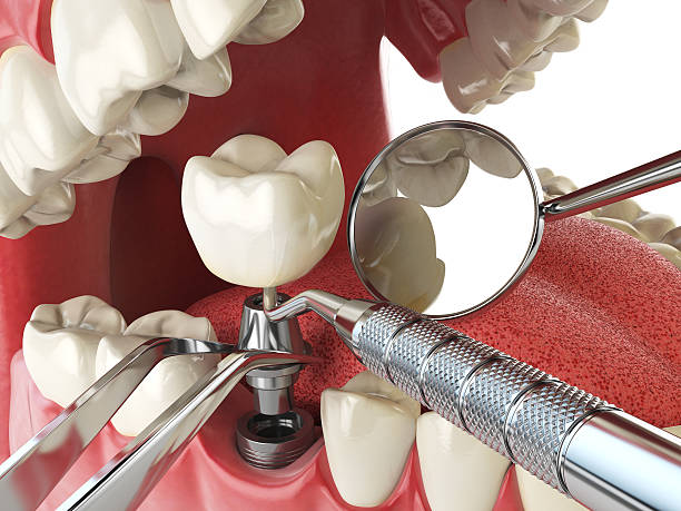 Best Urgent Dental Care for Toothache in Henderson, NC